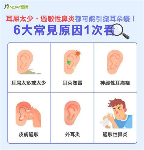 右耳朵癢|耳朵好癢抓不停？揭6大耳朵癢原因 可靠這招正確舒緩